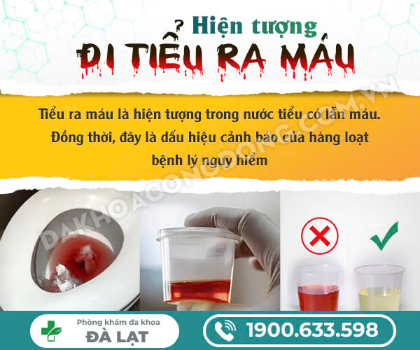 CÁCH CHỮA TIỂU RA MÁU